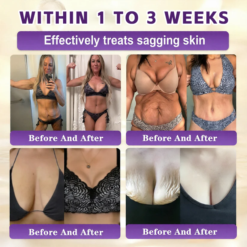 Biotin 10-in-1  Restoration Cream