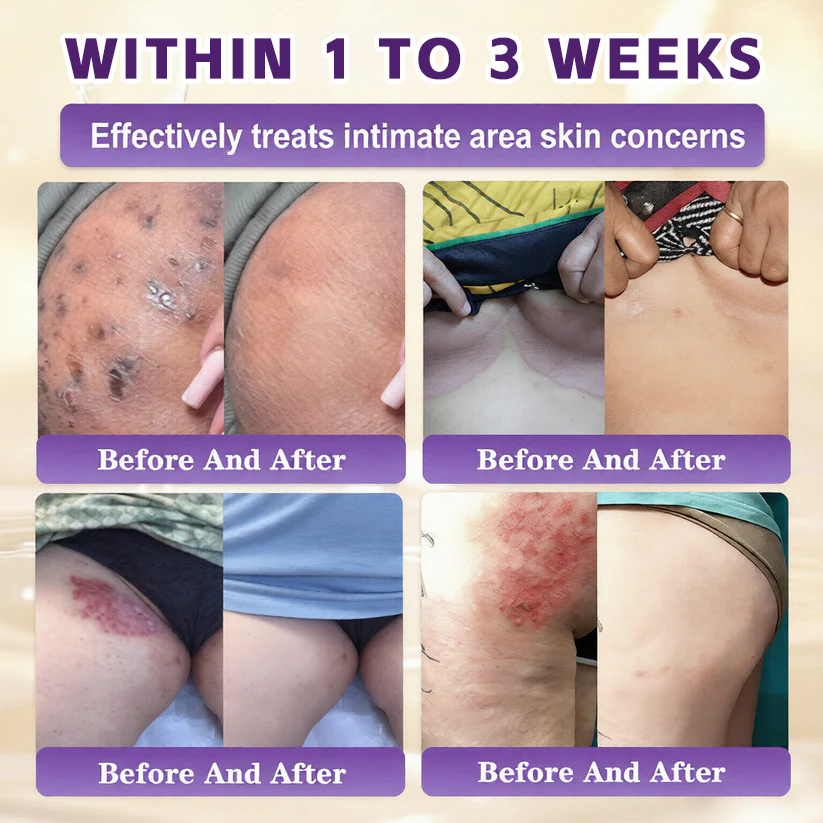 Biotin 10-in-1  Restoration Cream