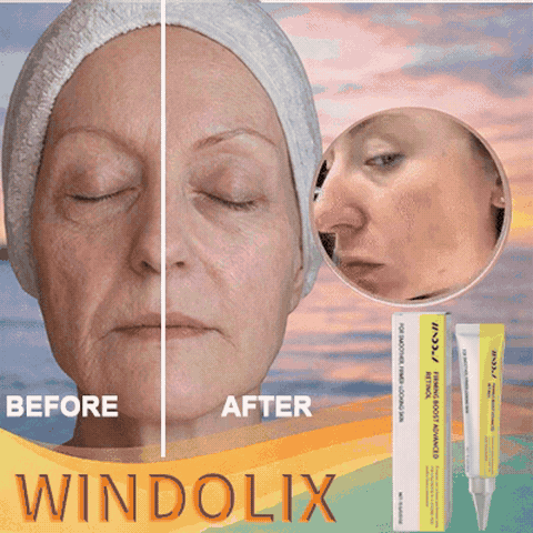 🔥 2026 BEST-SELLER SALE — Up to 50% OFF! 🔥  ✨ Get Remarkable Skin-Firming Results Without Expensive Treatments or Costly Maintenance! ✨